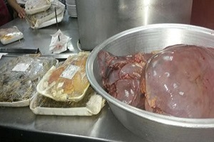 إعدام كبده فاسدة بالخليفة وحملة تفتيشية على منافذ اللحوم
